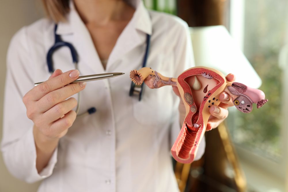 SOPK vs endométriose